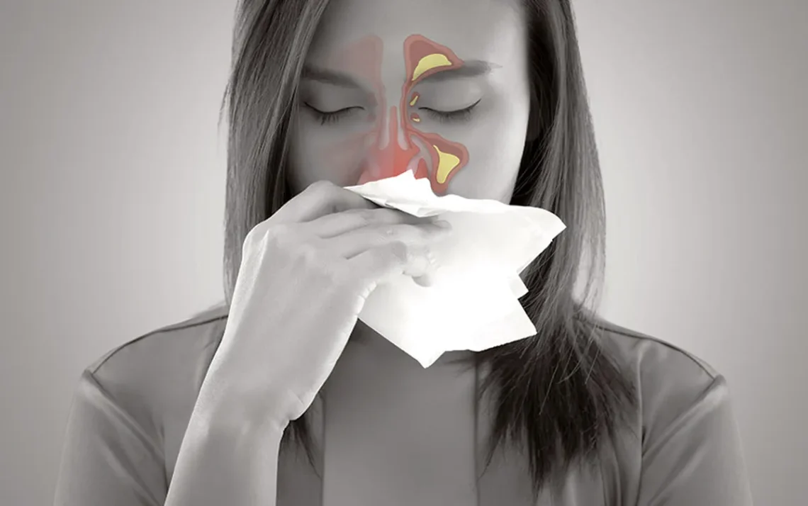 congestão nasal, alérgica ou viral
